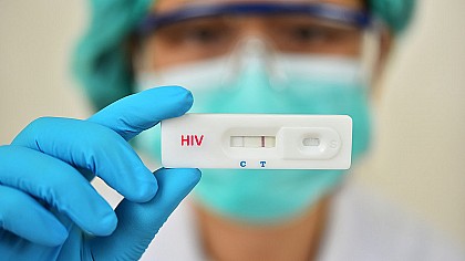 Unidades de Saúde de Avaré realizam teste rápido para HIV, sífilis e hepatites virais