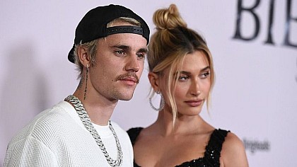 Após rumores de gravidez, esposa de Justin Bieber revela problema de saúde; saiba mais