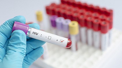 Campanha “Fique Sabendo” para detectar o vírus do HIV acontece neste sábado (3) em Paranapanema